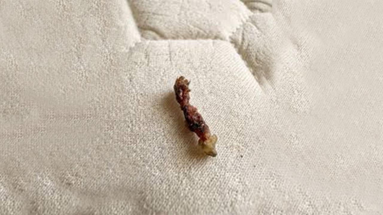 I Thought Bugs Were Crawling on Me at Night — The Real Cause Shocked Me