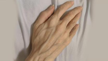 Visible Veins Suddenly Appearing? Here's When They're Normal and When to Worry