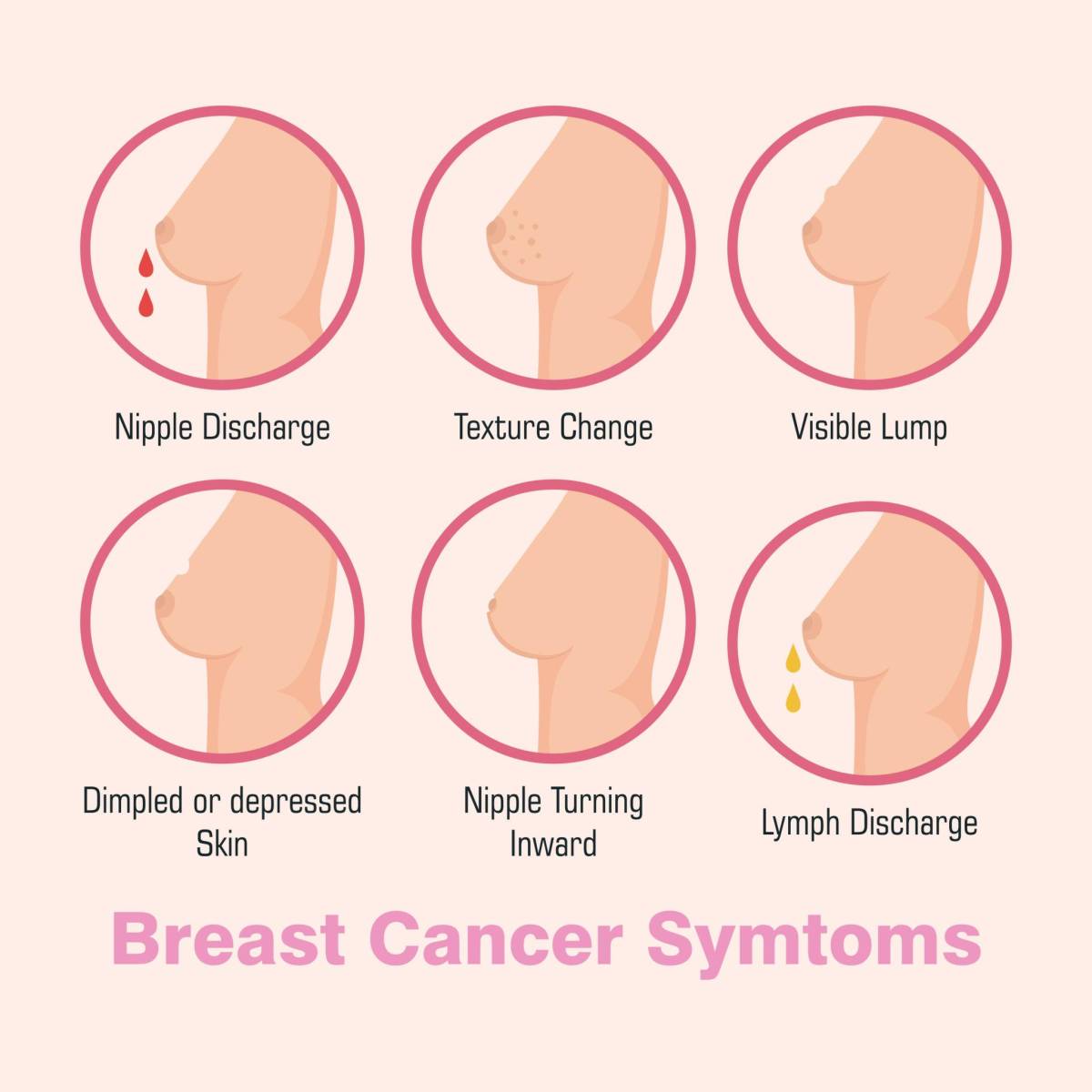The Body Whispers Before It Shouts: Early Breast Changes Every Woman Should Know