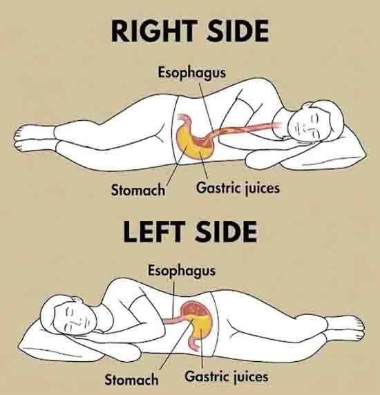 Why Your Favorite Sleeping Side Could Be Triggering Hidden Health Problems